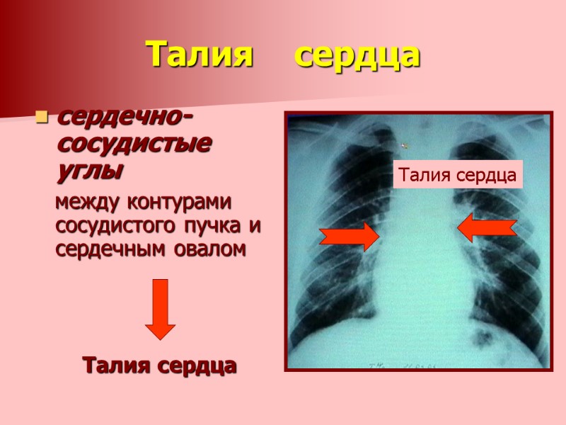 Талия    сердца сердечно-сосудистые углы    между контурами сосудистого пучка